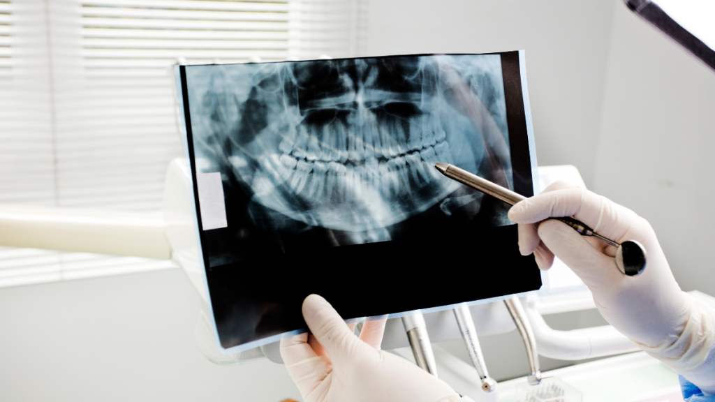 Dental Cleanings and Exams