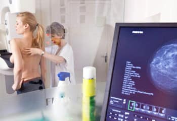 Google artificial intelligence for breast cancer screening