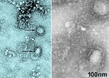The first picture of the Coronavirus, which they extracted from one of its victims, China